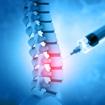 Cervical & Lumbar Nerve Root Injection clinic in Vijayawada